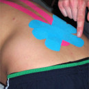 Kinesiotaping